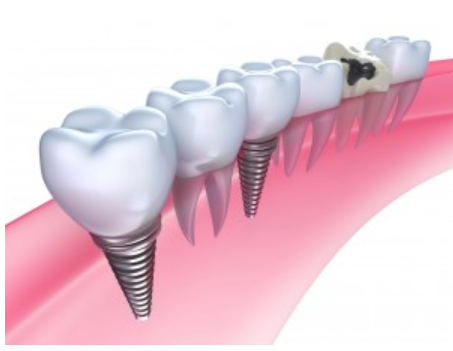 All On Four Dental Implants Long Island business image in Patchogue, NEW YORK